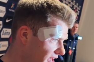 瑟尔洛特头部被撞后表示无碍：我没事，幸运的是没有脑震荡