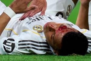 龙赛罗晒姆巴佩流血照：这就是西班牙裁判，内格雷拉仍在操控一切