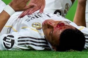 遭肘击血流不止!皇马官方:姆巴佩眉骨缝针,缺席球队今日合练