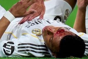 记者:24个摄像头仅1个拍到姆巴佩流血,VAR裁判当时不知道情况