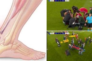 世界杯危！康复专家：埃基蒂克可能是跟腱断裂，将缺席9-12个月