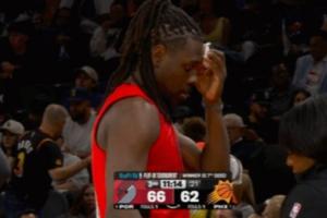 不下火线!朱·霍勒迪眉骨出血 队医场边紧急处理一下